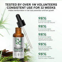 Thumbnail for Hair Growth Rosemary Oil - LightsBetter