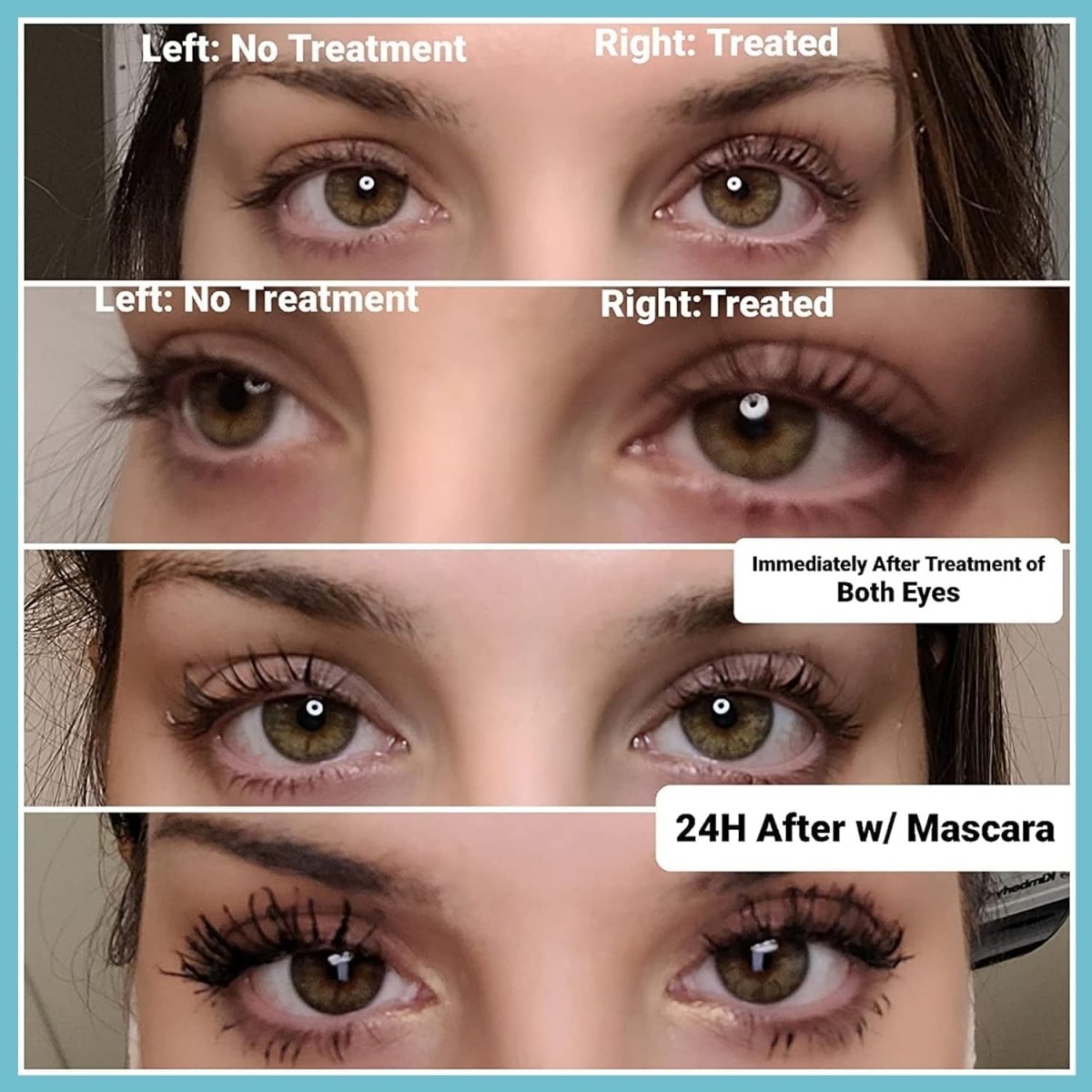 Lash Lift Kit - LightsBetter